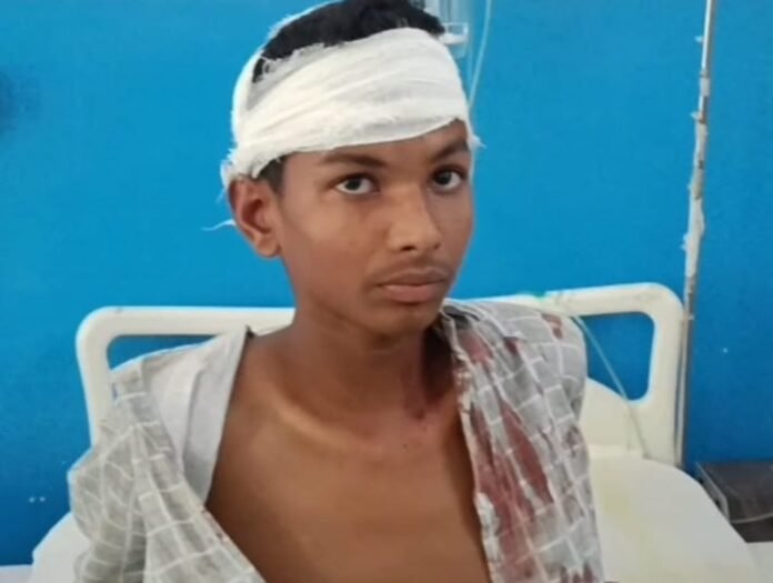 सारण घायल छात्र शाहिद अली