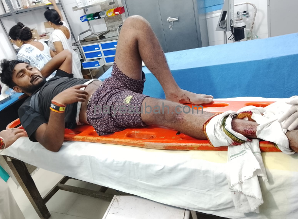 अस्पताल में इलाज रत घायल चालक