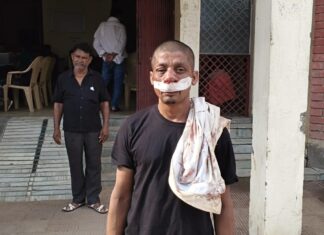 चार लाख रुपये बकाया मांगना पड़ा भारी, लोहे की रॉड से हमला कर युवक को किया घायल; आरोपी गिरफ्तार घायल युवक