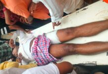 औरंगाबाद में सीएसपी संचालक पर अपराधियों का हमला, जांघ में गोली मारकर तीन लाख रुपये लूटे सदर अस्पताल औरंगाबाद में इलाजरत सीएसपी संचालक