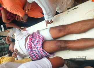 औरंगाबाद में सीएसपी संचालक पर अपराधियों का हमला, जांघ में गोली मारकर तीन लाख रुपये लूटे सदर अस्पताल औरंगाबाद में इलाजरत सीएसपी संचालक